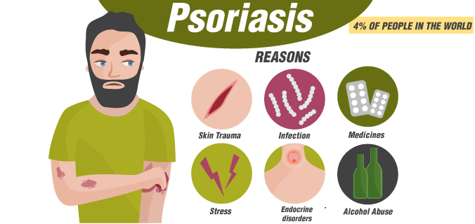 Main reasons of psoriasis